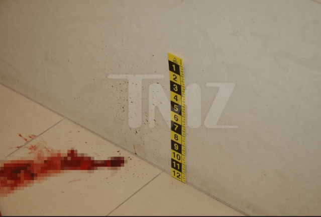 Screenshot-2018-6-27 Anonymous Detective CHRIS CORNELL – “A Staged Suicide” The Metal Den